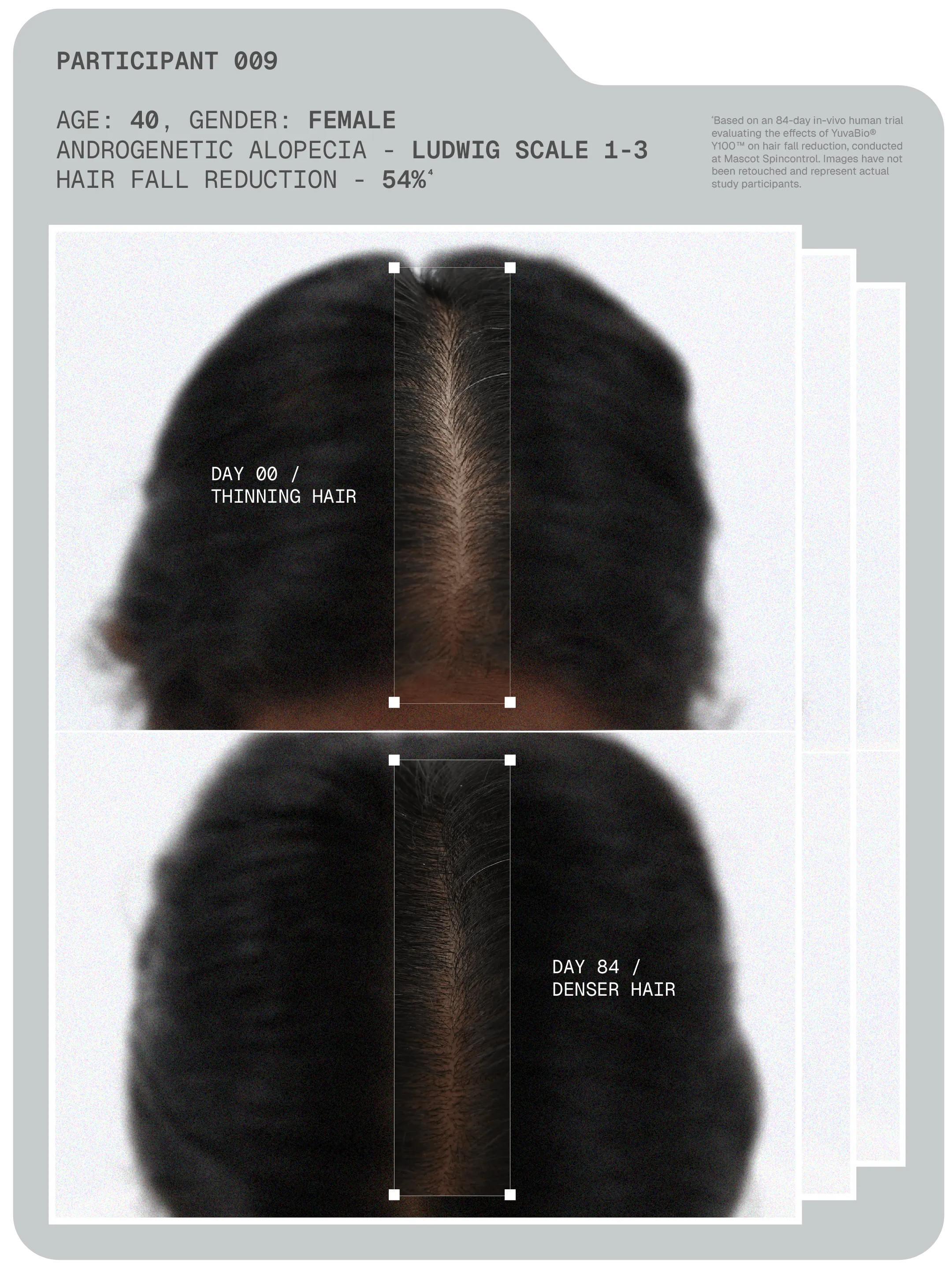 Arata MitoActive™ Mitochondrial Hair Growth Serum 30 ml Pack of 2