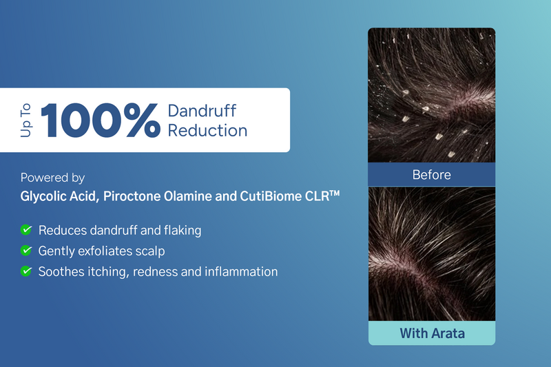 anti-dandruff-shampoo-and-tonic A+