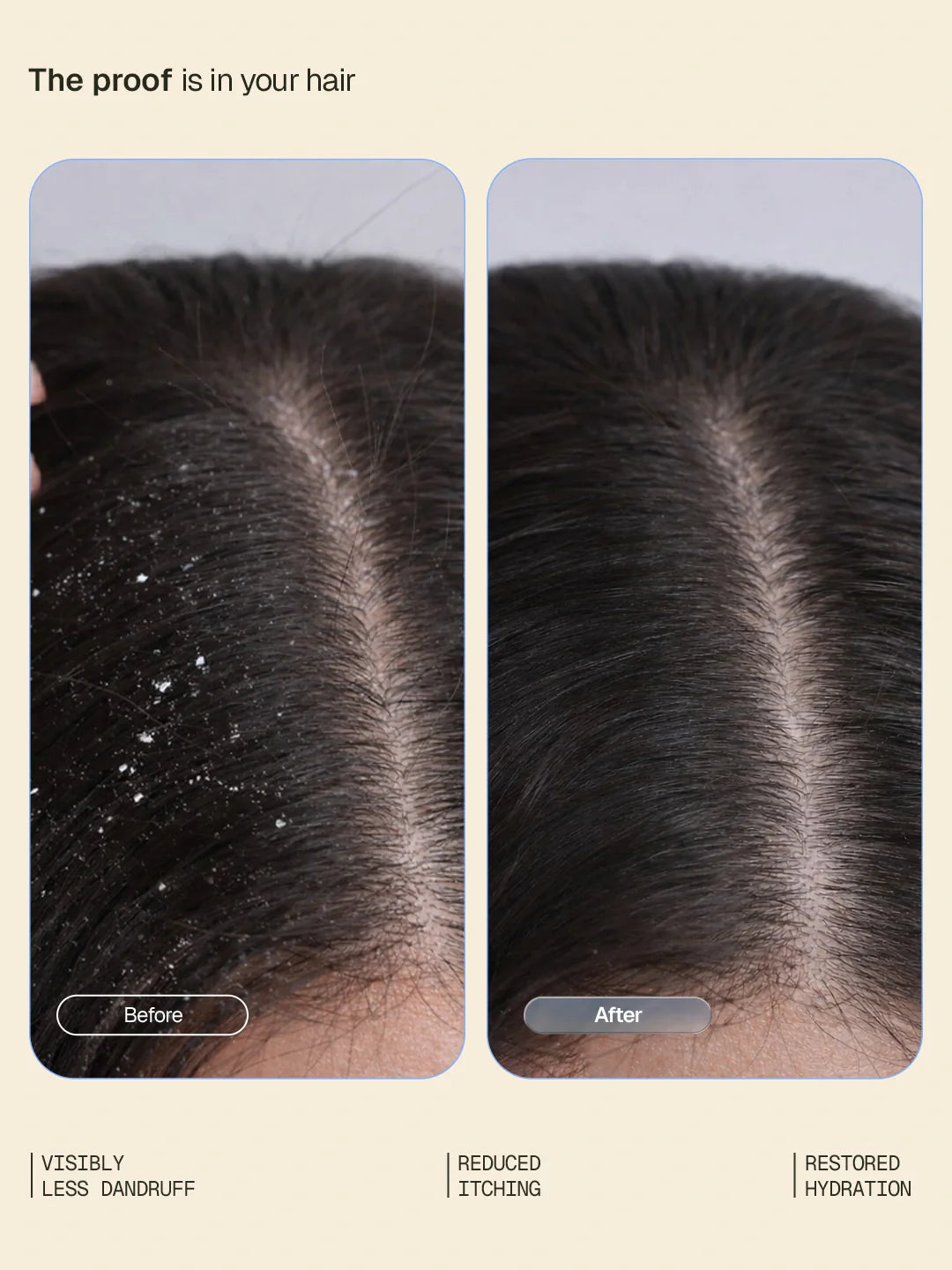 Anti-DandruffSystemWebsiteSecondary_2