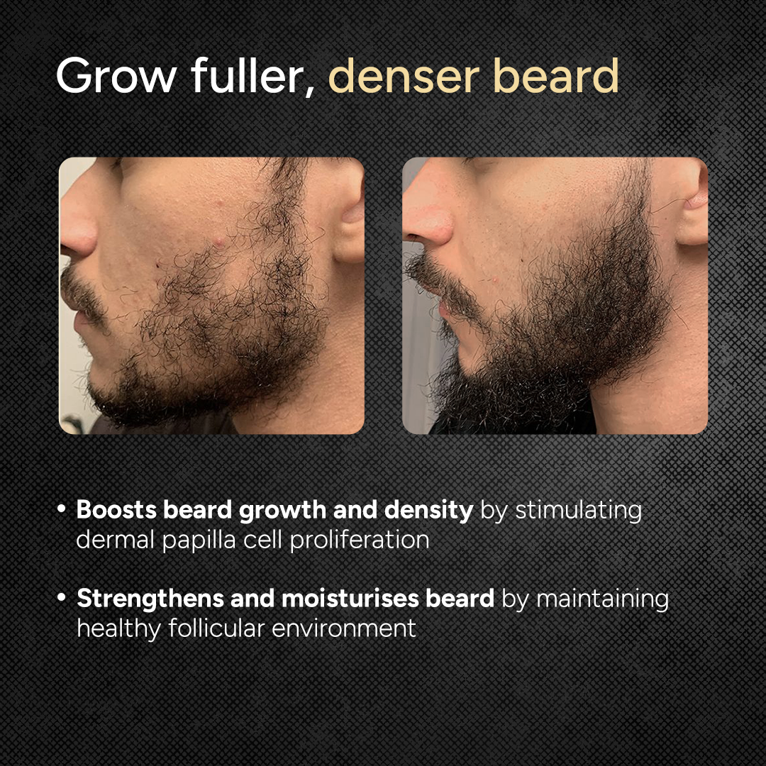 Beard Growth Oil - 30ml