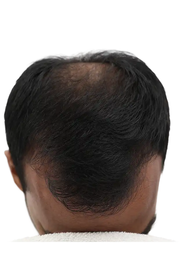 Before treatment