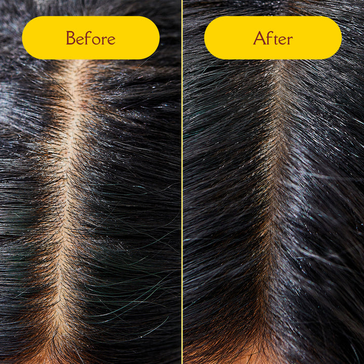 Hair Growth Regime with Capilia Longa | Oil 100ml + Scrub 50g + Serum 100ml