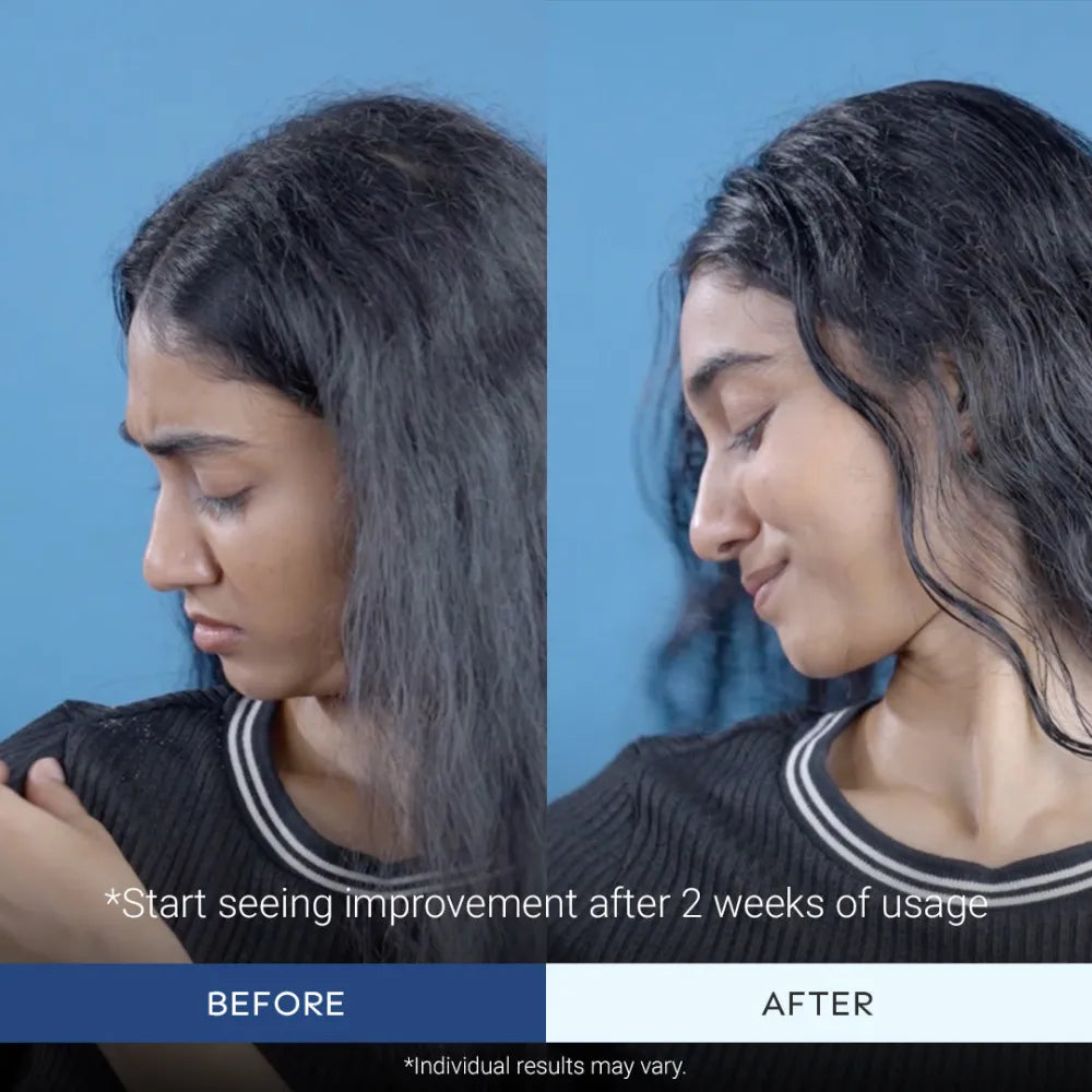 Super Shampoo™ and Anti-Dandruff Conditioner Combo (300ml + 200ml)