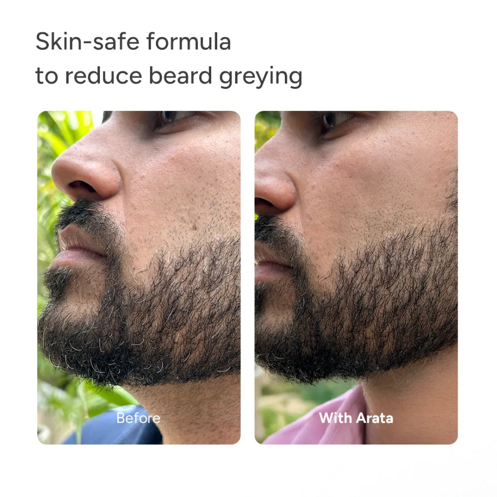 MelanoBoostª Anti-Grey Hair & Beard Serum with MelanoGrayª, Silverfreeª, Arcolys¨ & Vegan Keratin - 30ml