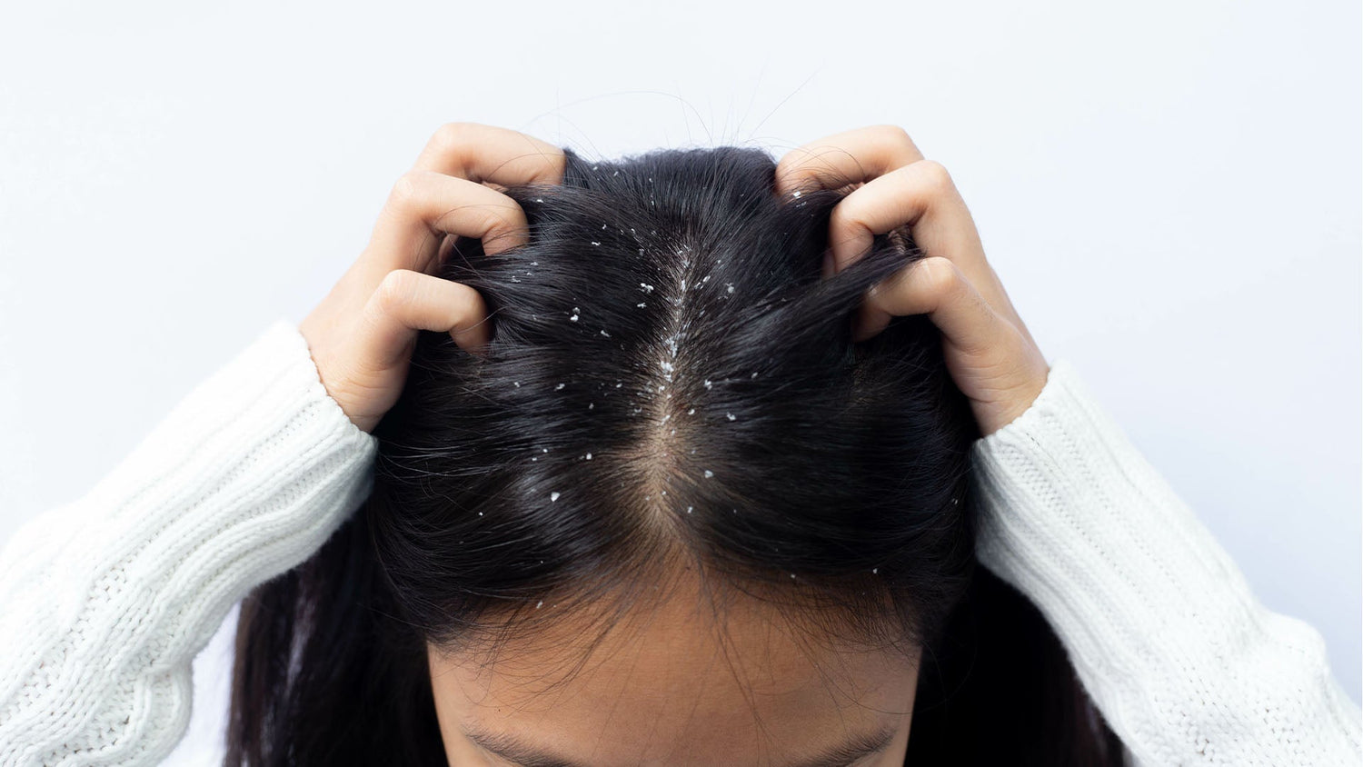 Arata Anti Dandruff Shampoo vs Others