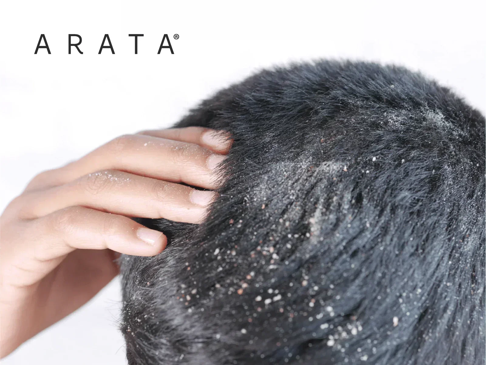 how-to-remove-dandruff-from-hair-step-by-step-guide