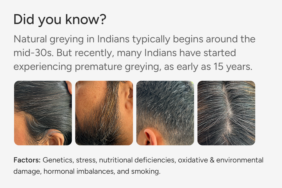 MelanoBoost™ Anti-Grey Hair & Beard Serum with MelanoGray™, Silverfree™, Arcolys® & Vegan Keratin - 30ml