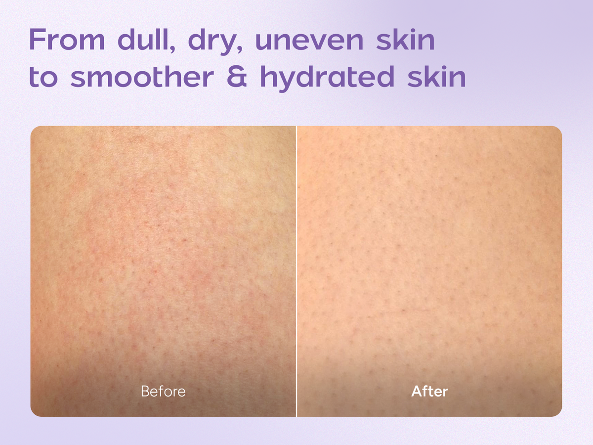 Niacinamide Body Milk A+(M)