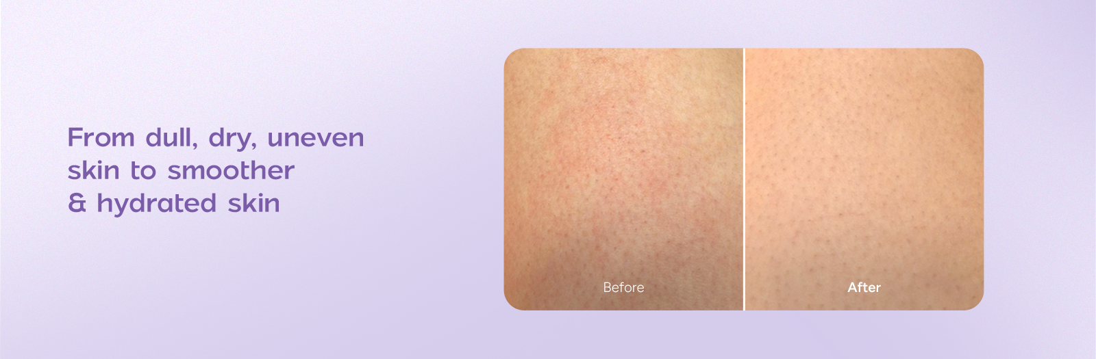 Niacinamide Body Milk A+