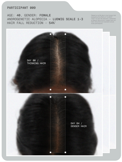 MitoActive™ Mitochondrial Hair Growth Serum -  30 ml - Pack of 2