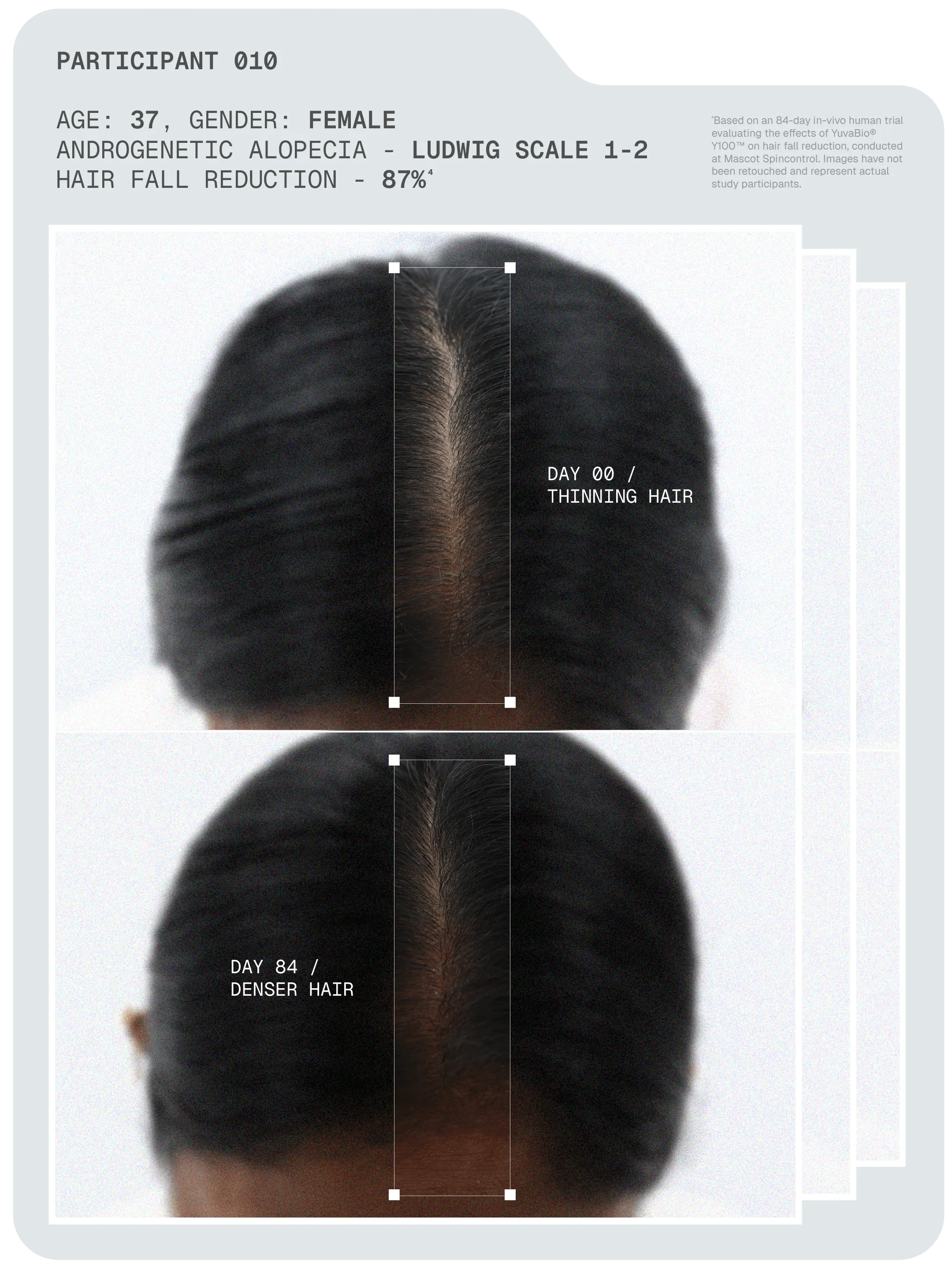Arata MitoActive™ Mitochondrial Hair Growth Serum 30 ml Pack of 2