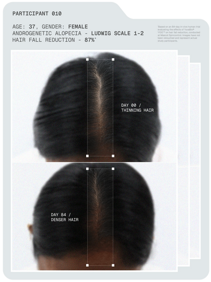 MitoActive™ Mitochondrial Hair Growth Serum -  30 ml - Pack of 2