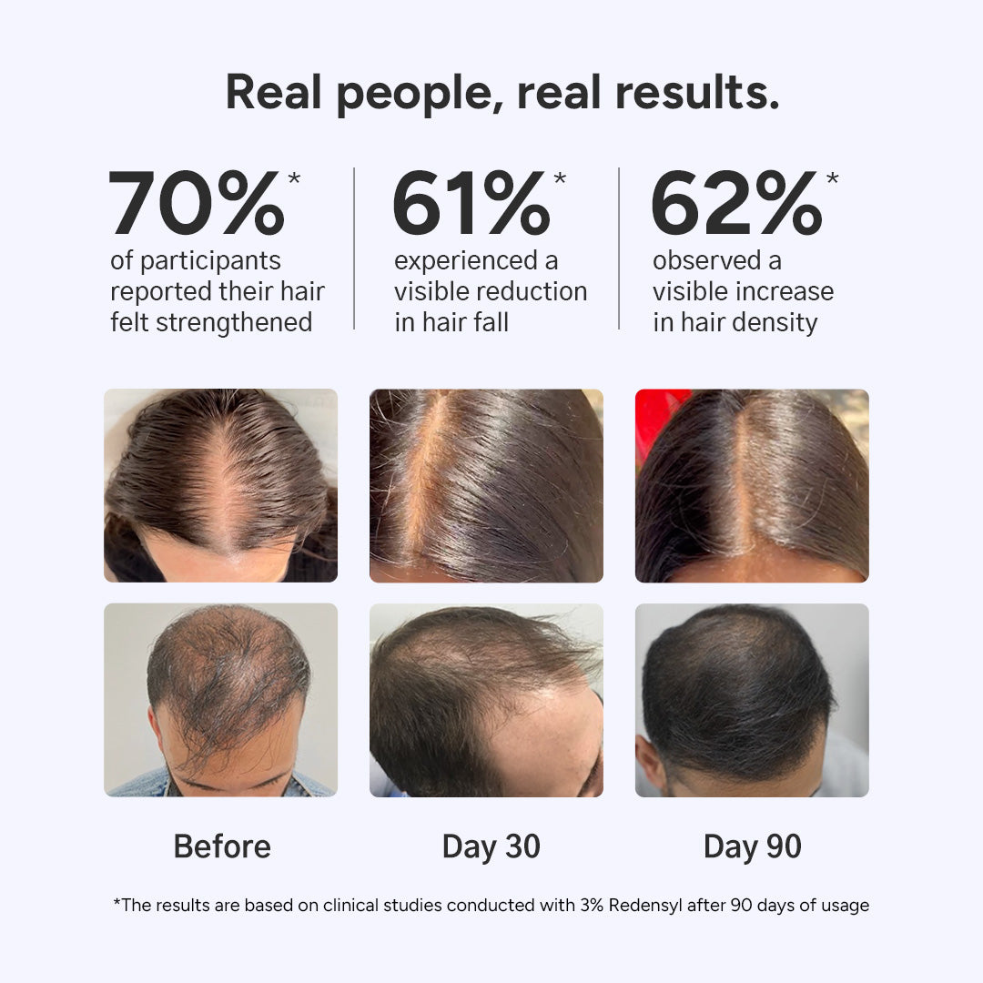 Arata Hair Growth Serum for Men and Women | For Fuller, Denser, Thicker Hair Growth | Free Derma Roller