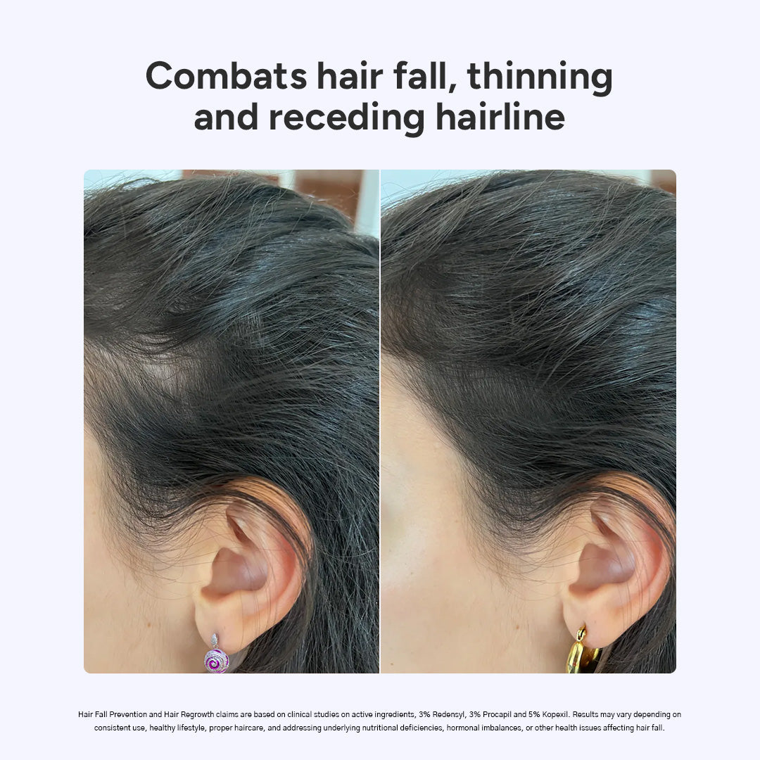 Before and after comparison of hair thickness on an ear, with text indicating hair fall and thinning combating effects.