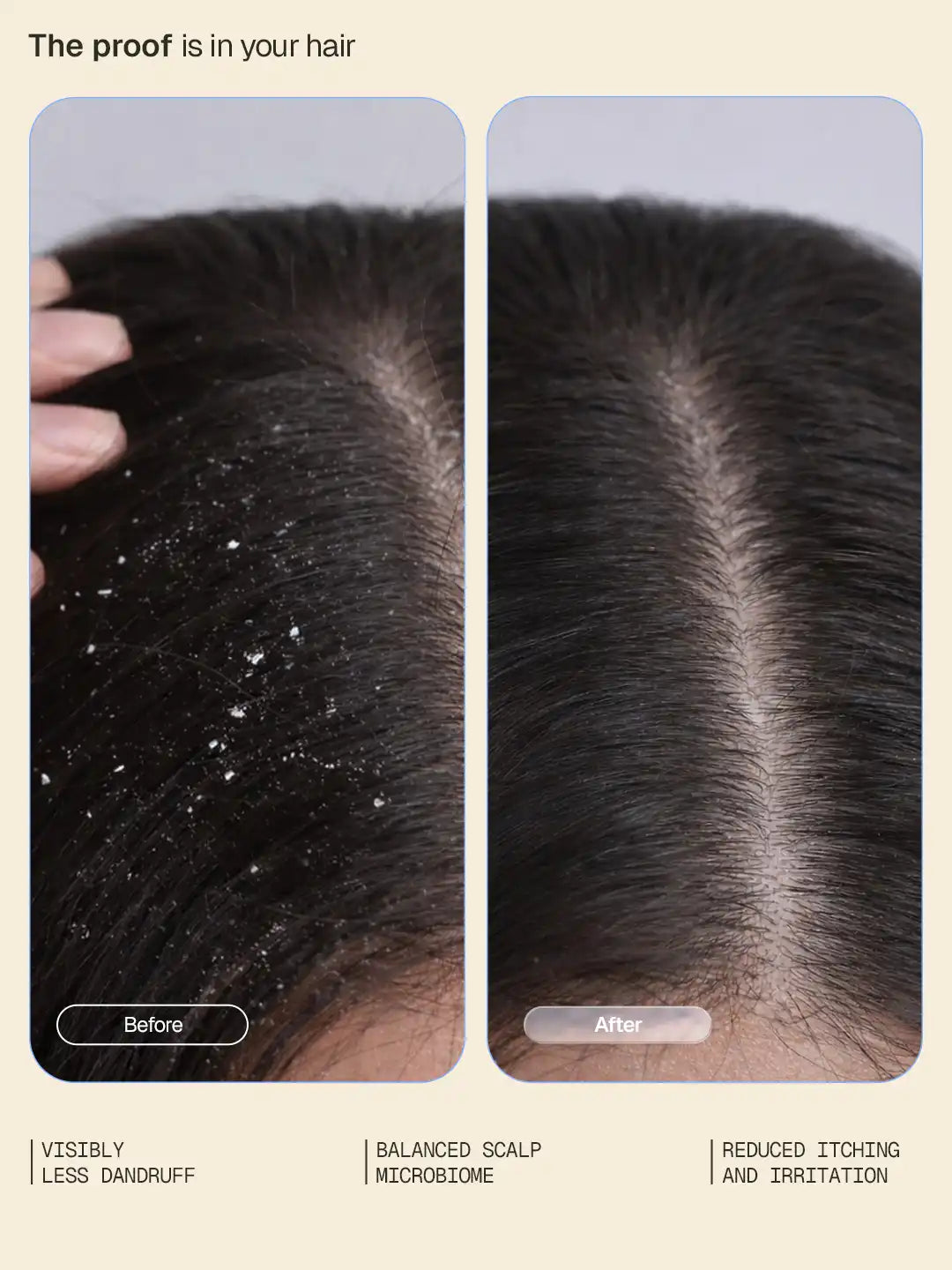 Arata Anti-Dandruff Shampoo & Serum Combo