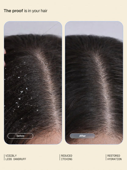 Anti-DandruffSystemWebsiteSecondary_2