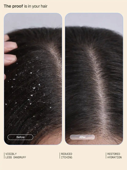 Anti-Dandruff_Shampoo_Conditioner_Duo_Myntra_Secondary_Card_2