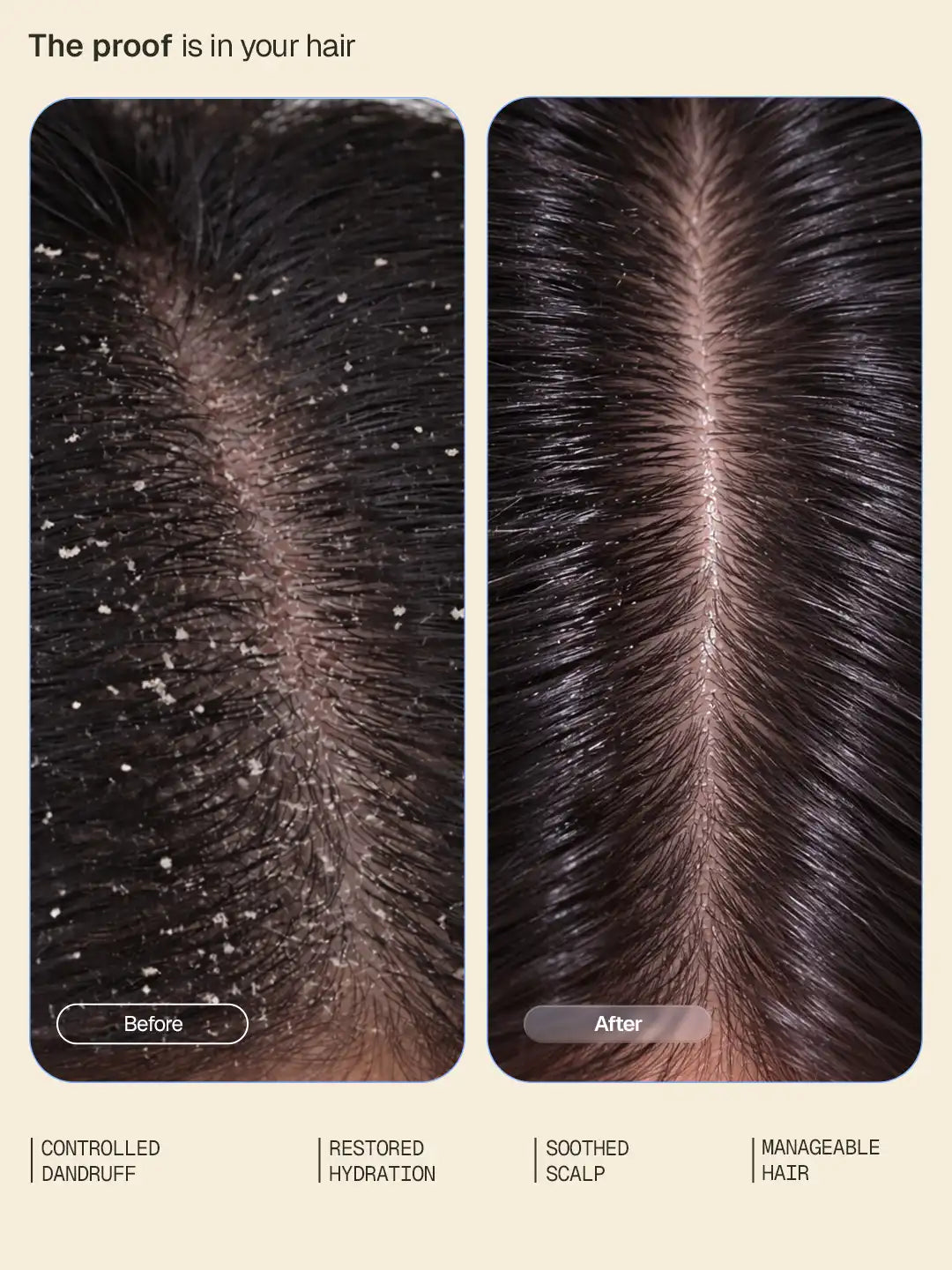 Anti-Dandruff Conditioner - 200 ml - BYOB