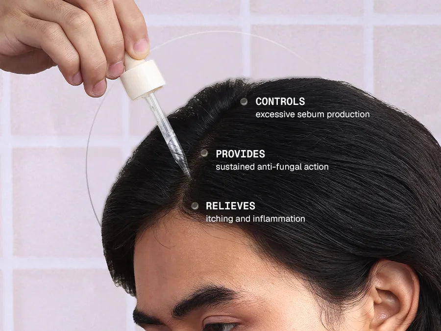 Anti_Dandruff_Serum_Amazon_Mobile_A__Card_2_d648b1c3-0b0b-4fb5-a964-bf7102c957a6