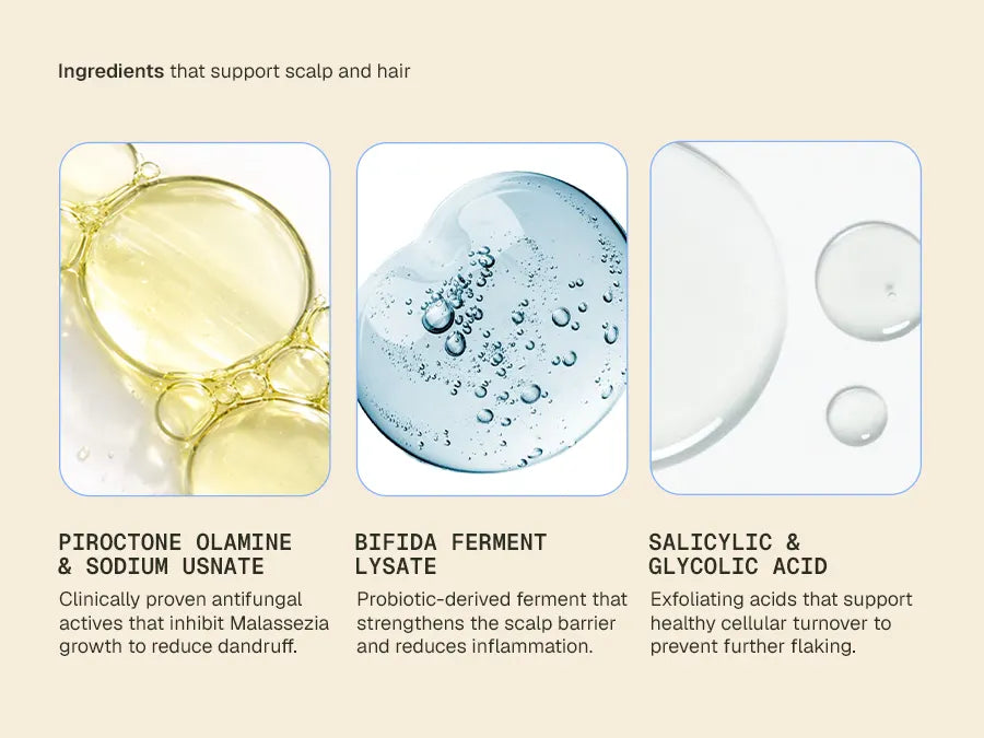 Anti_Dandruff_Serum_Amazon_Mobile_A__Card_4_bd4dbbc4-22be-4a5b-b947-3c070f16dc59