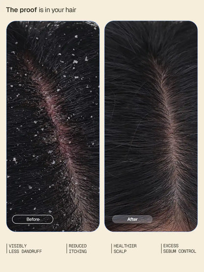 Anti_Dandruff_Serum_Website_Secondaries_Card_2