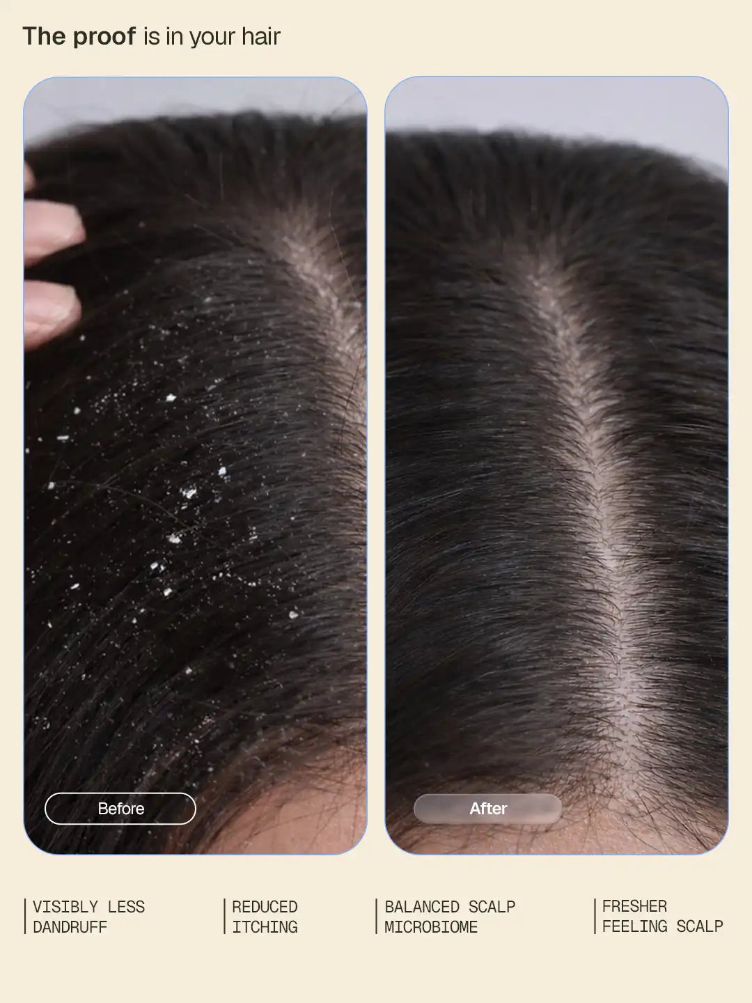 Anti-Dandruff Shampoo - 200 ml - BYOB