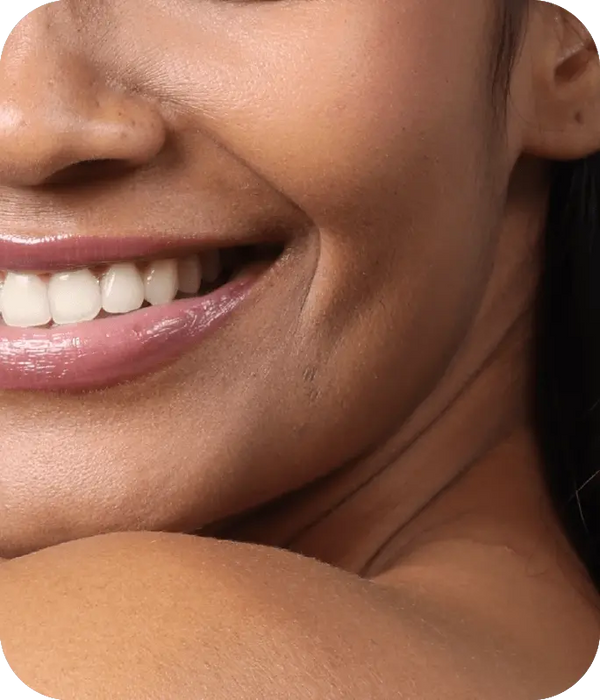 Oily skin needsfrequent, aggressive washing to stay clear.