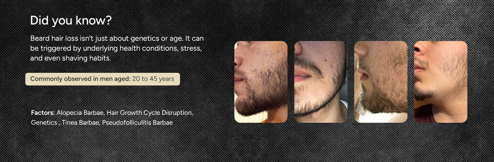 Beard Oil Secondaries