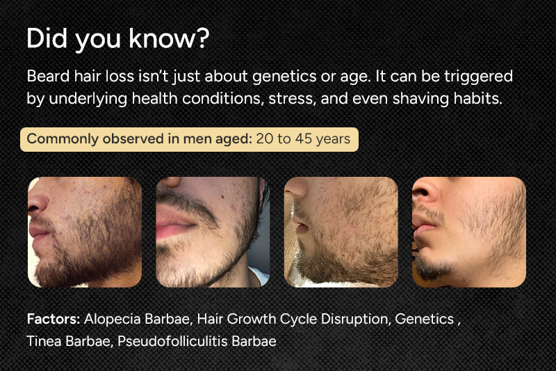 Beard Oil Secondaries