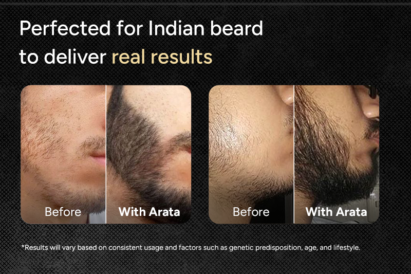 Before and after comparison of Indian beard growth with Arata product.
