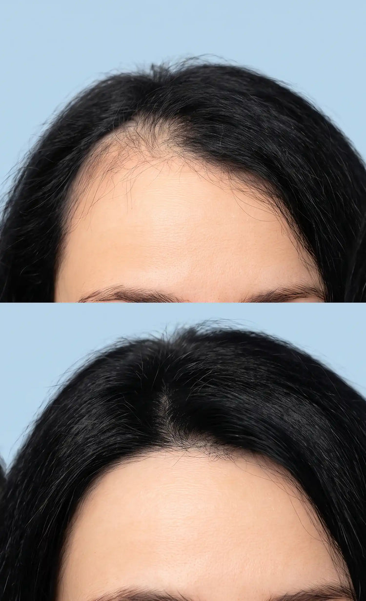 Boosts new<br>hair growth