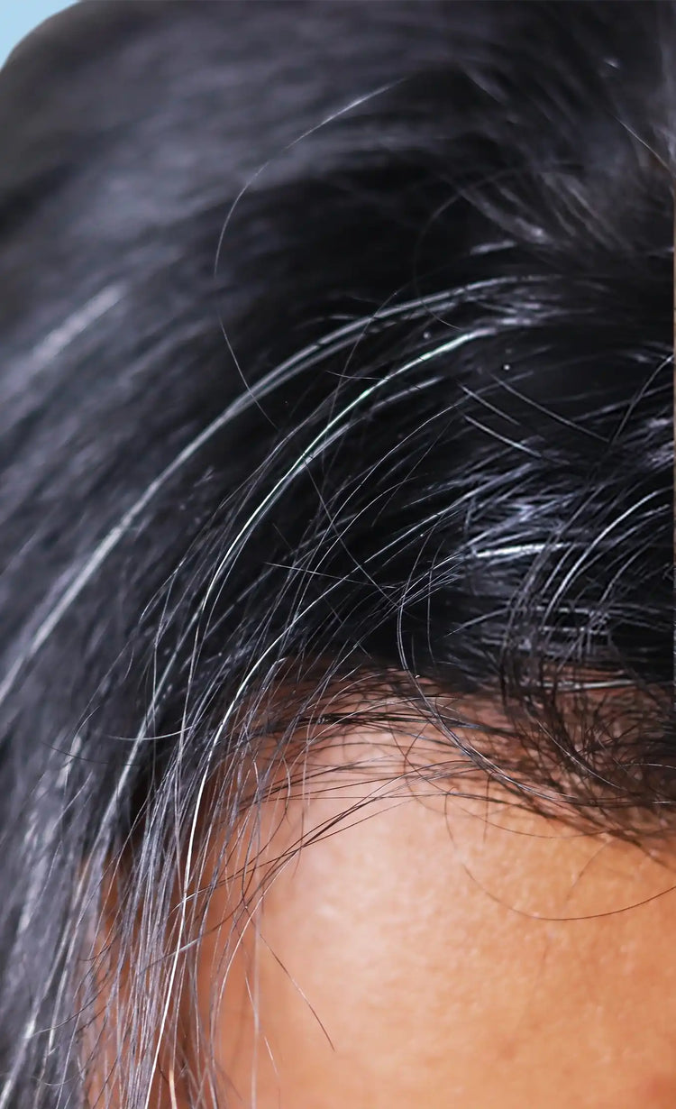 Boosts pigmented hair growth