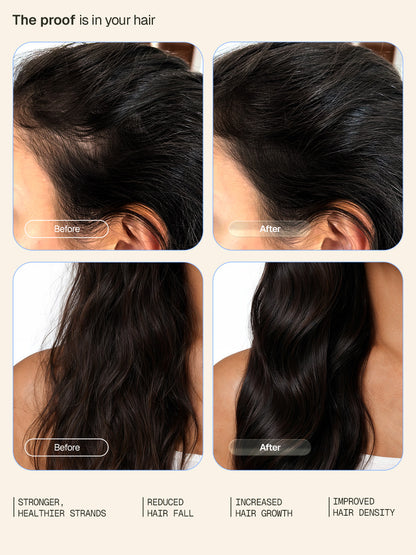 Damage Defence Shampoo & Hair Growth Intensive Serum Combo