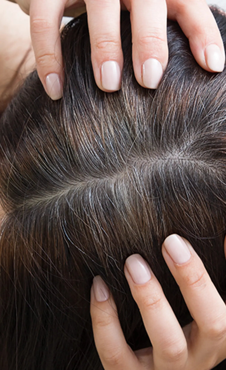 Balances scalp microbiome