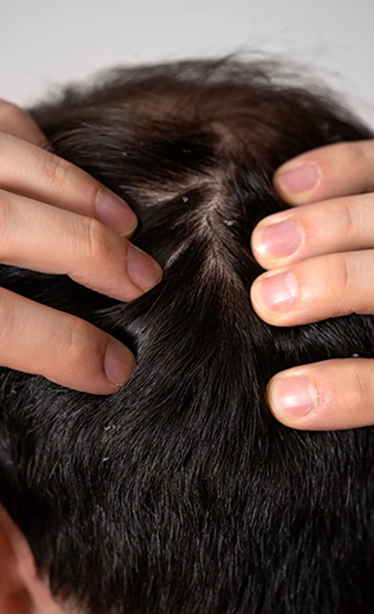 Reduced<br>dandruff
