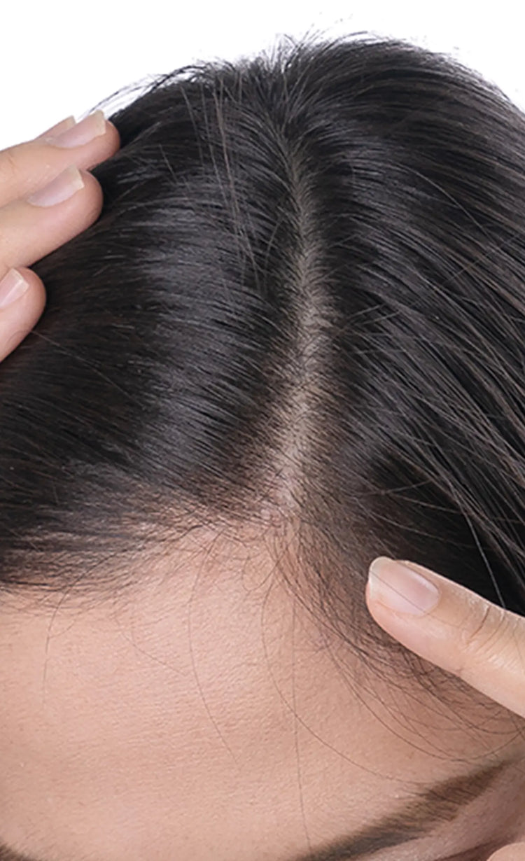 Soothed<br>scalp