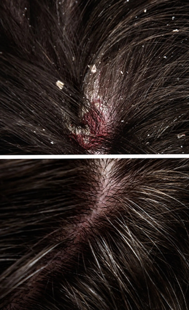 Sustained anti-fungal action
