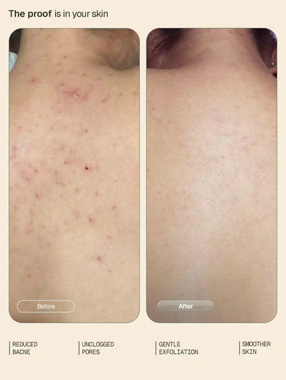 Exfoliating_Body_Wash_Lotion_Duo_Website_Secondary_Card_2