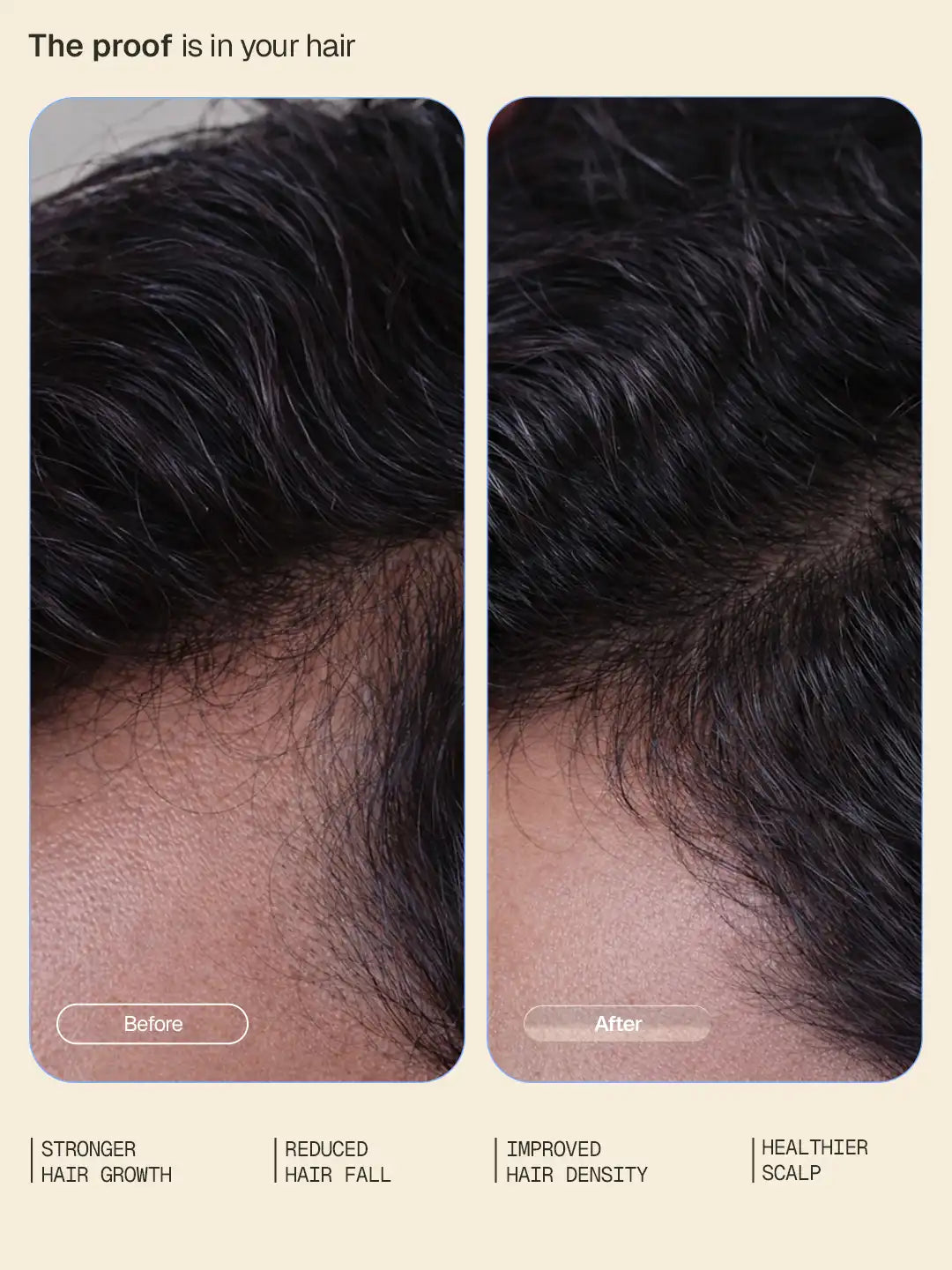 Hair Growth Intensive Serum - 30 ml - BYOB