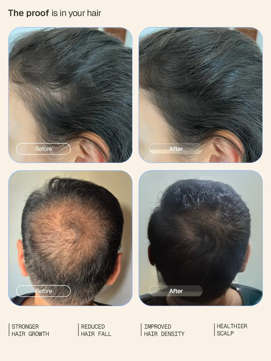 Arata Arata Hair Growth Intensive Serum Pack of 3