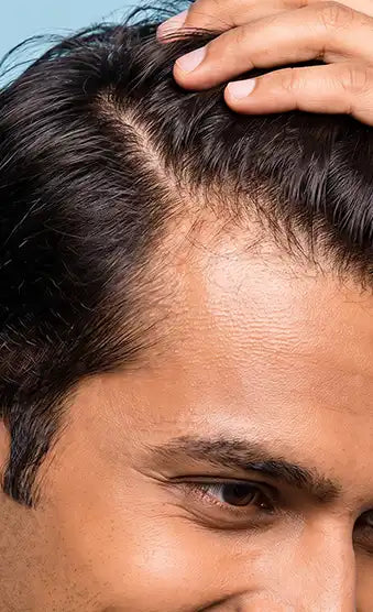 Improves<br>scalp environment