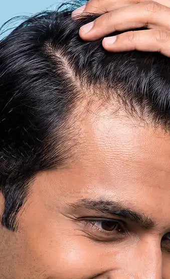 Improves scalp<br>environment