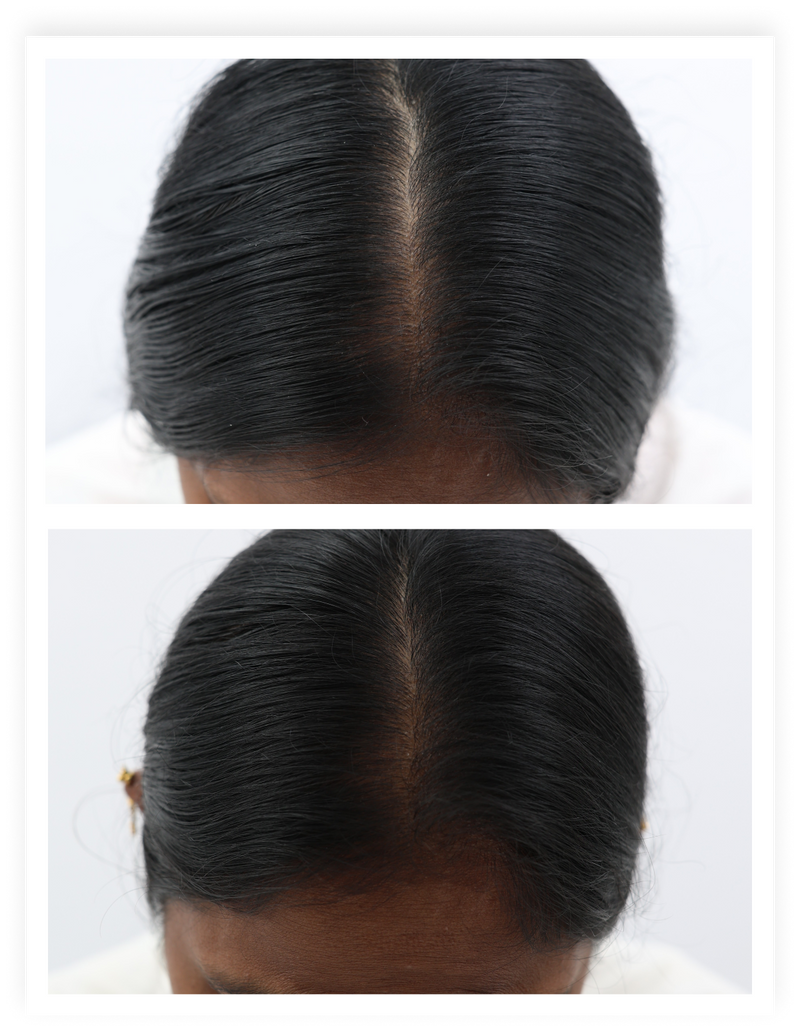 Before / after