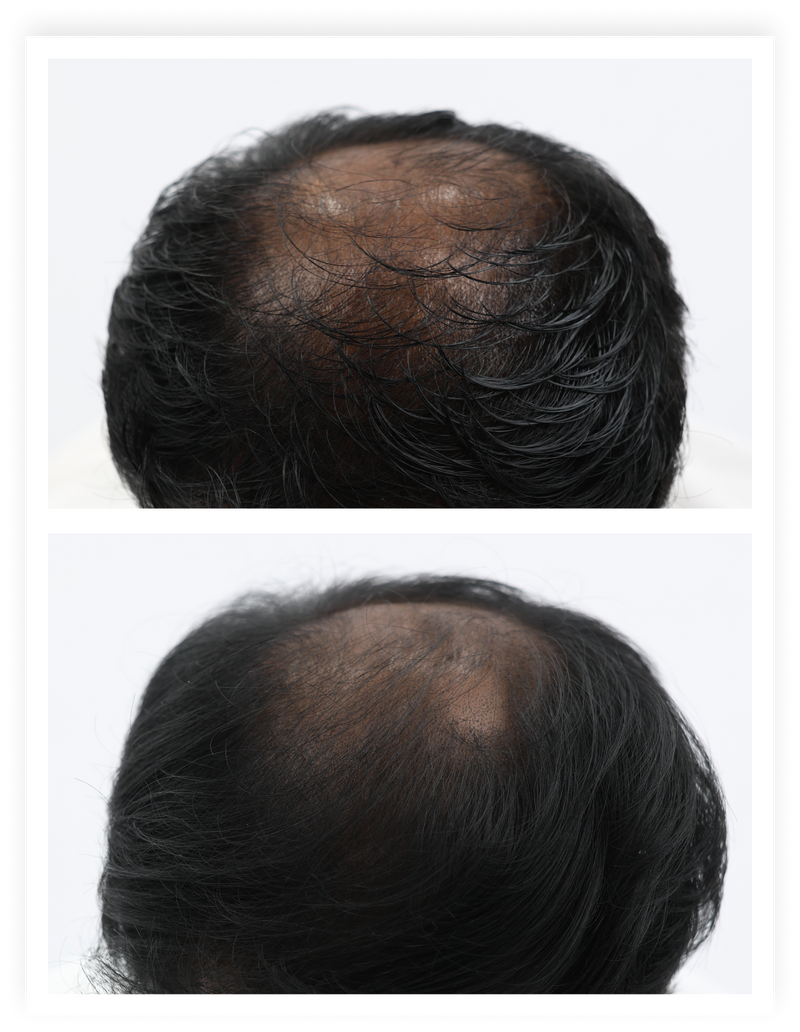 Before / after
