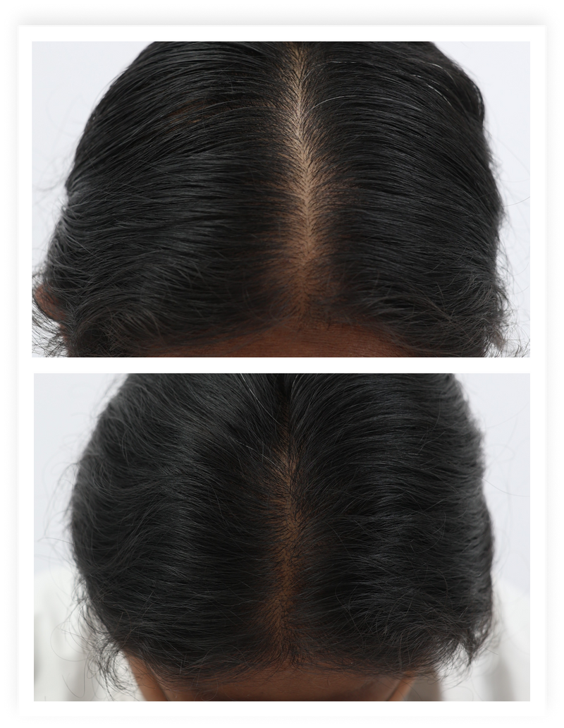 Before / after