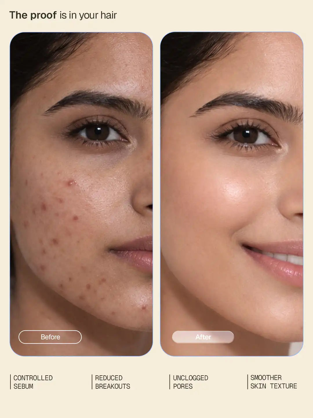 Oil-Control_Face_Wash_Website_Secondaries_Card_2