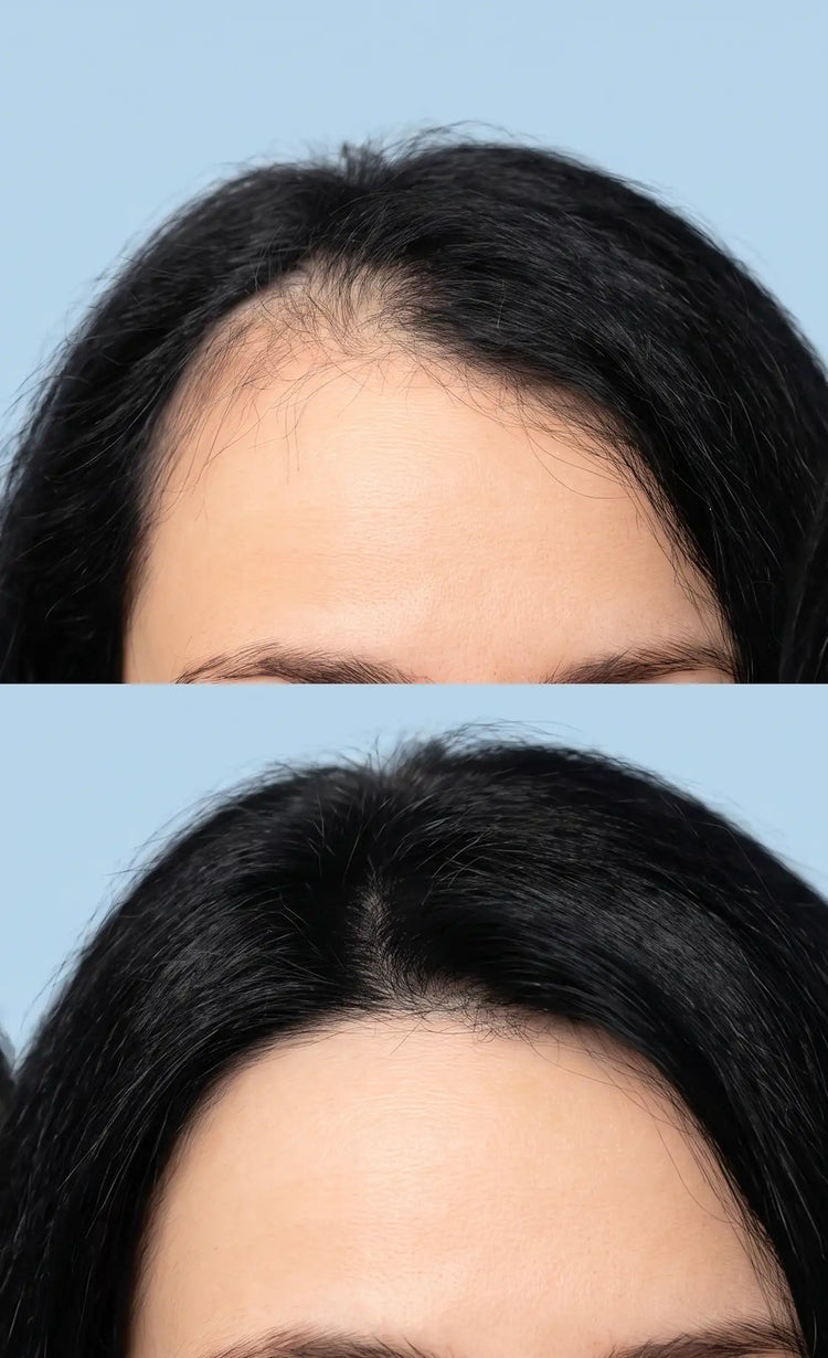 Promotes new<br>hair growth