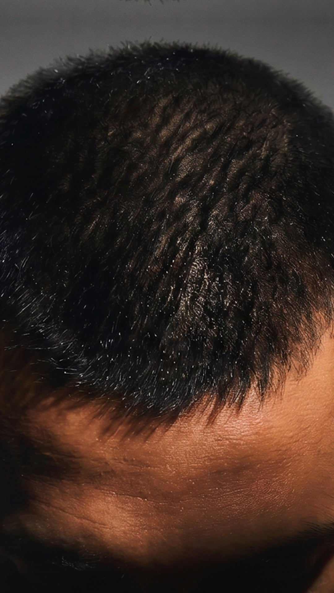 Close-up of scalp