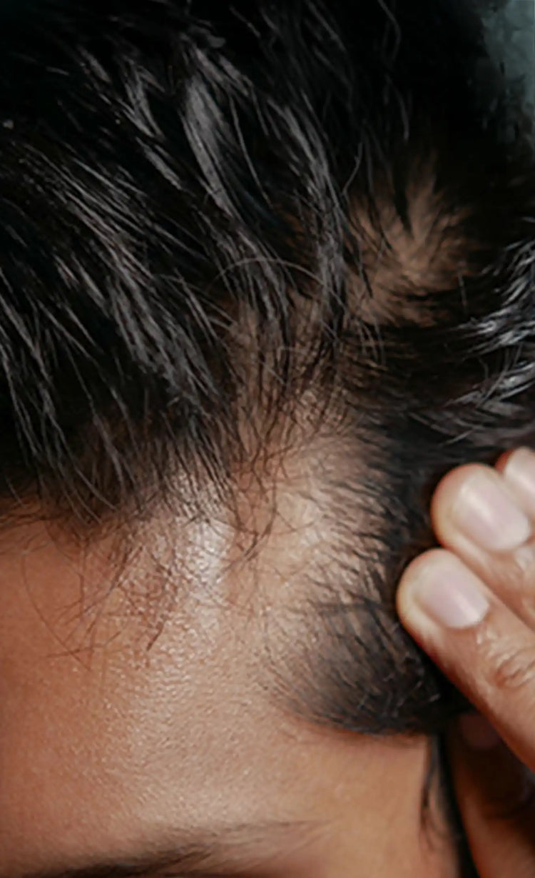 Reduced<br>hair fall