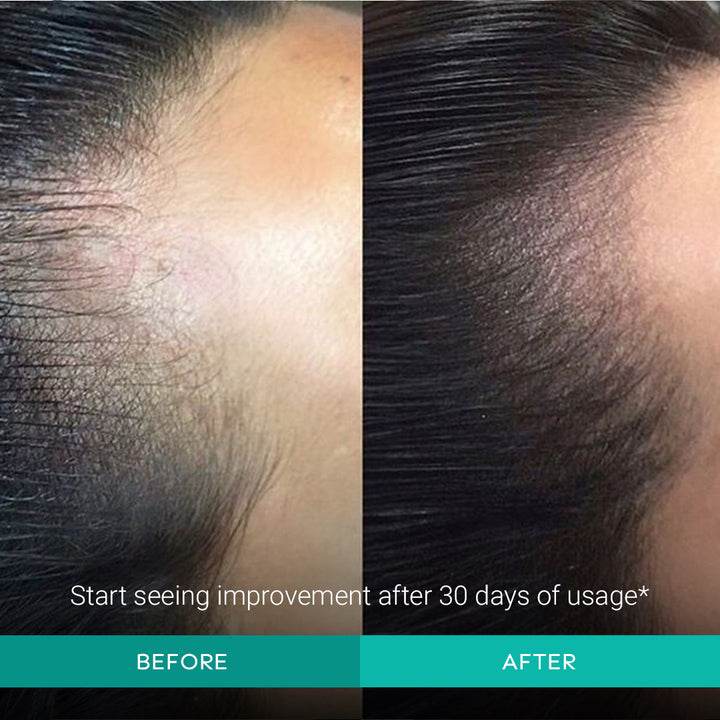 Intensive Hair Growth Serum - 30ml – Arata